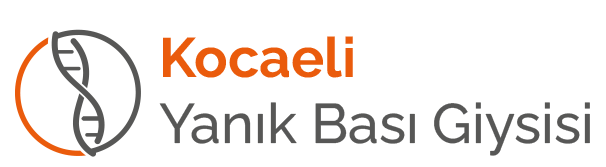 Kocaeli Yanik Basigiysisi